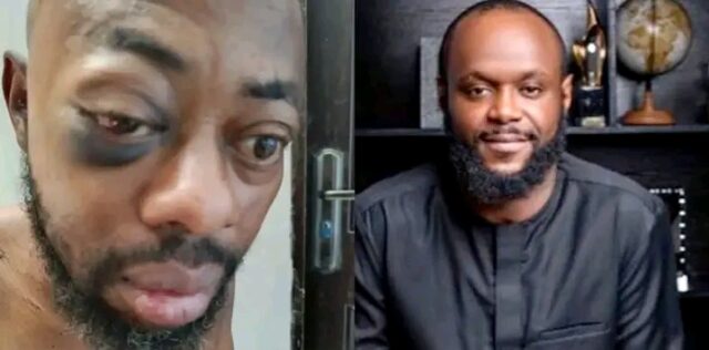 Seyi Tinubu Tried To Bribe Me With N100M, Had Me Abducted, Beaten, Stripped Naked — NANS President