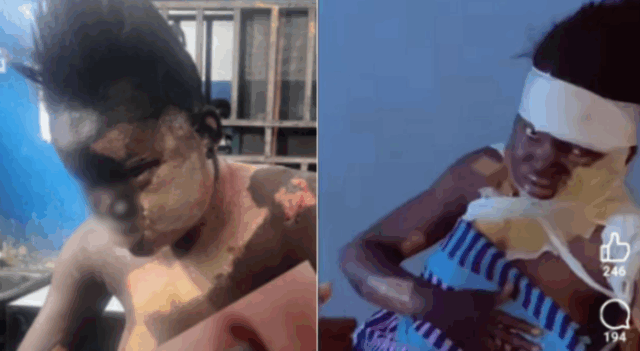 BREAKING: Woman Pours Boiling Water on Boyfriend’s Co-Worker